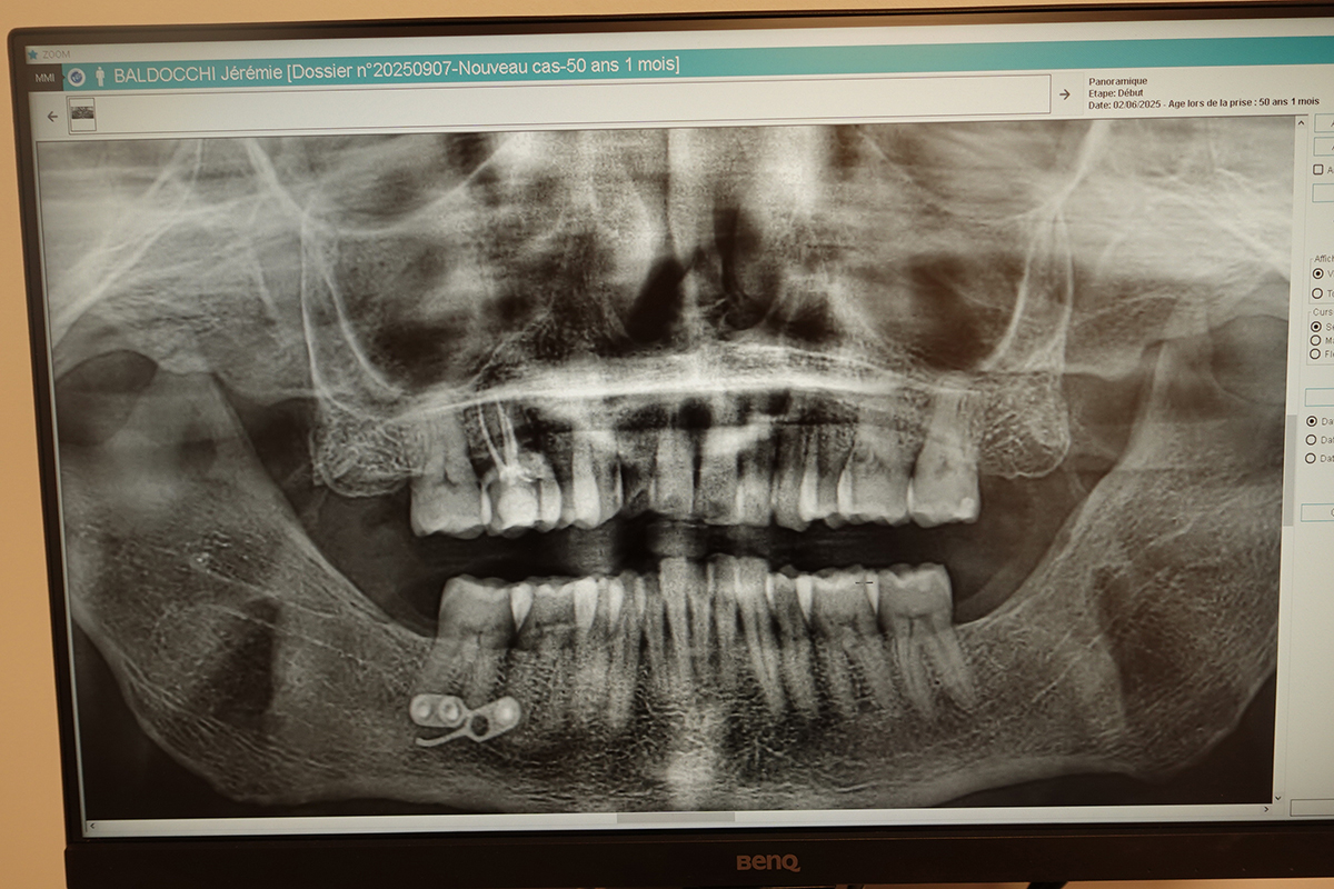 Insipration graphique chez le dentiste prise le 02-06-2025